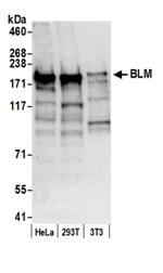 BLM Antibody in Western Blot (WB)