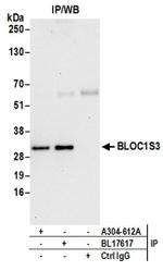 BLOC1S3 Antibody in Western Blot (WB)