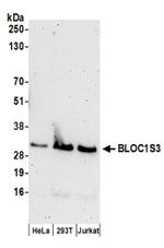 BLOC1S3 Antibody in Western Blot (WB)