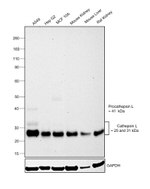 Cathepsin L Antibody in Western Blot (WB)