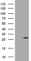 BNIP1 Antibody in Western Blot (WB)