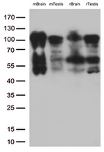 BRAF Antibody in Western Blot (WB)