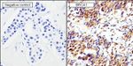 BRCA1 Antibody in Immunohistochemistry (Paraffin) (IHC (P))