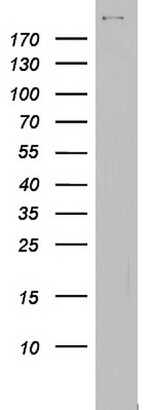 BRCA1 Antibody in Western Blot (WB)