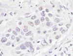 BRD3 Antibody in Immunohistochemistry (IHC)