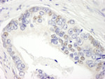 BRD3 Antibody in Immunohistochemistry (IHC)