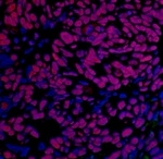 BRD4 Antibody in Immunohistochemistry (Paraffin) (IHC (P))