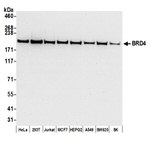 BRD4 Antibody in Western Blot (WB)