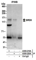 BRD8 Antibody in Western Blot (WB)