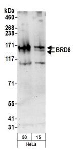 BRD8 Antibody in Western Blot (WB)