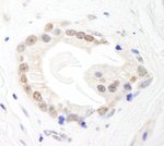 BRF1 Antibody in Immunohistochemistry (IHC)