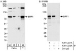 BRF1 Antibody in Western Blot (WB)