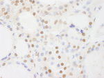 BRF1 Antibody in Immunohistochemistry (IHC)