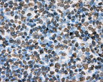 BSG Antibody in Immunohistochemistry (Paraffin) (IHC (P))