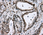 BSG Antibody in Immunohistochemistry (Paraffin) (IHC (P))