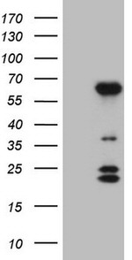 BTBD10 Antibody in Western Blot (WB)