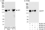 BTF Antibody in Western Blot (WB)