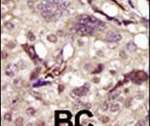 Btk Antibody in Immunohistochemistry (IHC)