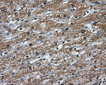 BTK Antibody in Immunohistochemistry (Paraffin) (IHC (P))