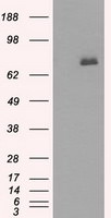 BTK Antibody in Western Blot (WB)