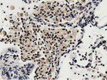 BTN1A1 Antibody in Immunohistochemistry (Paraffin) (IHC (P))