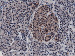 BTN1A1 Antibody in Immunohistochemistry (Paraffin) (IHC (P))