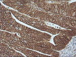 Beta-catenin Antibody in Immunohistochemistry (Paraffin) (IHC (P))