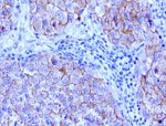 Beta-catenin Antibody in Immunohistochemistry (Paraffin) (IHC (P))