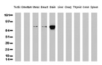 Beta-catenin Antibody in Western Blot (WB)