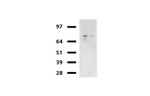 Beta-catenin Antibody in Western Blot (WB)