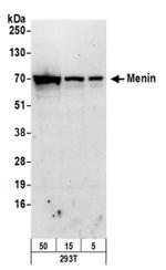 Menin Antibody in Western Blot (WB)