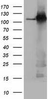 BuB1B Antibody in Western Blot (WB)