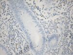 C10orf54 Antibody in Immunohistochemistry (Paraffin) (IHC (P))