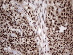 C14orf166 Antibody in Immunohistochemistry (Paraffin) (IHC (P))