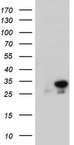 RTRAF Antibody in Western Blot (WB)