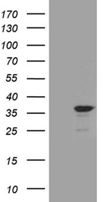C14orf80 Antibody in Western Blot (WB)