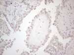 C19ORF80 Antibody in Immunohistochemistry (Paraffin) (IHC (P))