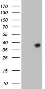 C21orf62 Antibody in Western Blot (WB)