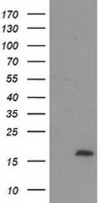 C2orf40 Antibody in Western Blot (WB)