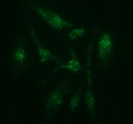 C2orf62 Antibody in Immunocytochemistry (ICC/IF)