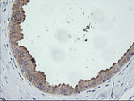 C2orf62 Antibody in Immunohistochemistry (Paraffin) (IHC (P))