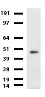 CA12 Antibody in Western Blot (WB)