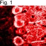 Calmodulin Antibody in Immunohistochemistry (IHC)