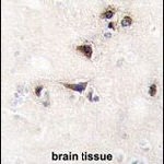 CaMKII alpha Antibody in Immunohistochemistry (IHC)