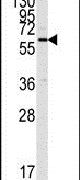 CaMKII alpha Antibody in Western Blot (WB)