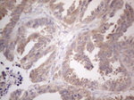 CAMK2B Antibody in Immunohistochemistry (Paraffin) (IHC (P))