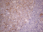 CAMK2B Antibody in Immunohistochemistry (Paraffin) (IHC (P))