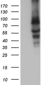 CAPN5 Antibody in Western Blot (WB)