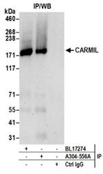 CARMIL Antibody in Western Blot (WB)