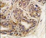 CASC3 Antibody in Immunohistochemistry (IHC)